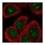 Atlas Antibodies Anti-TAF1C Antibody
