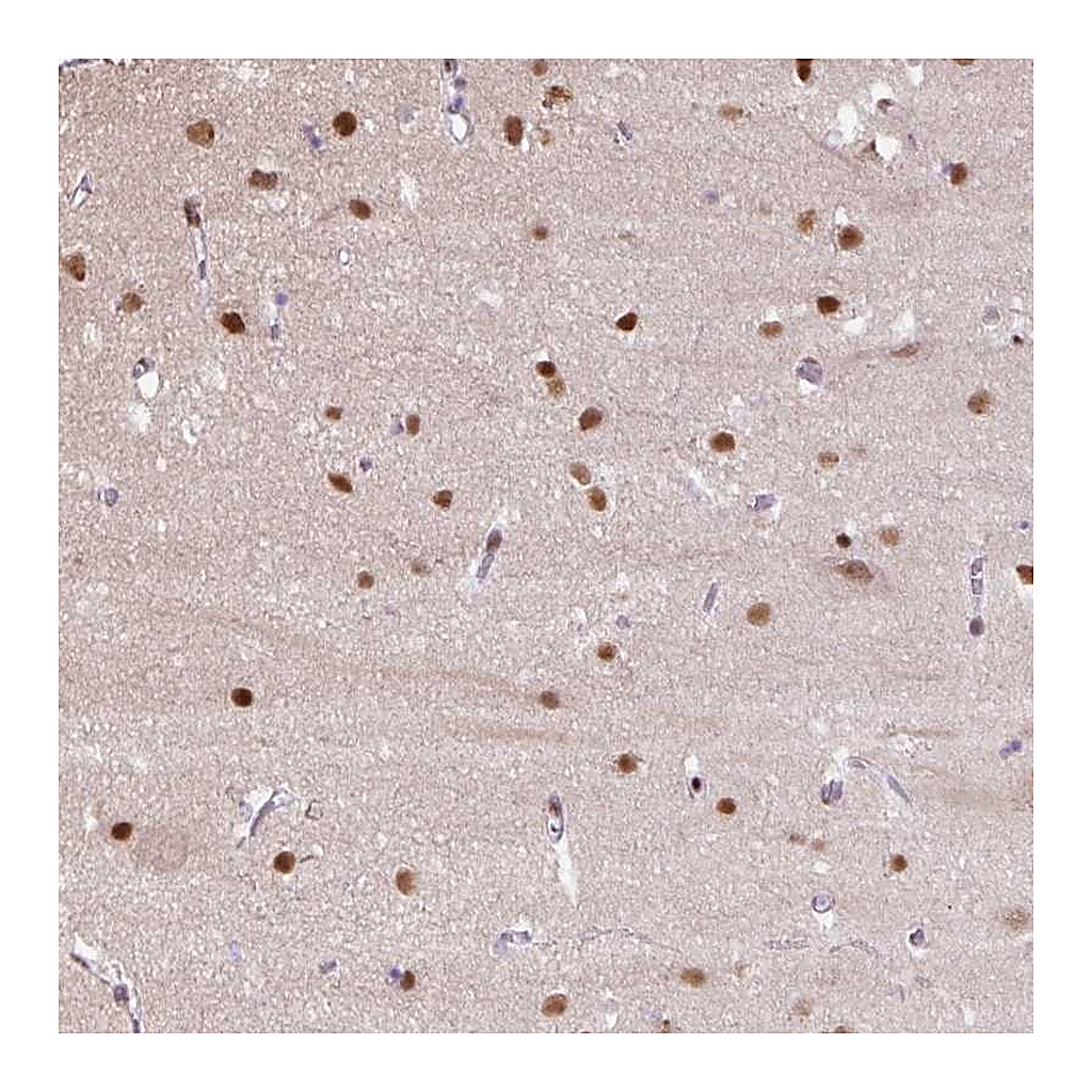 Atlas Antibodies Anti-TAF1A Antibody
