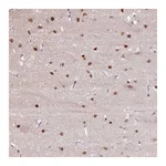 Atlas Antibodies Anti-TAF1A Antibody