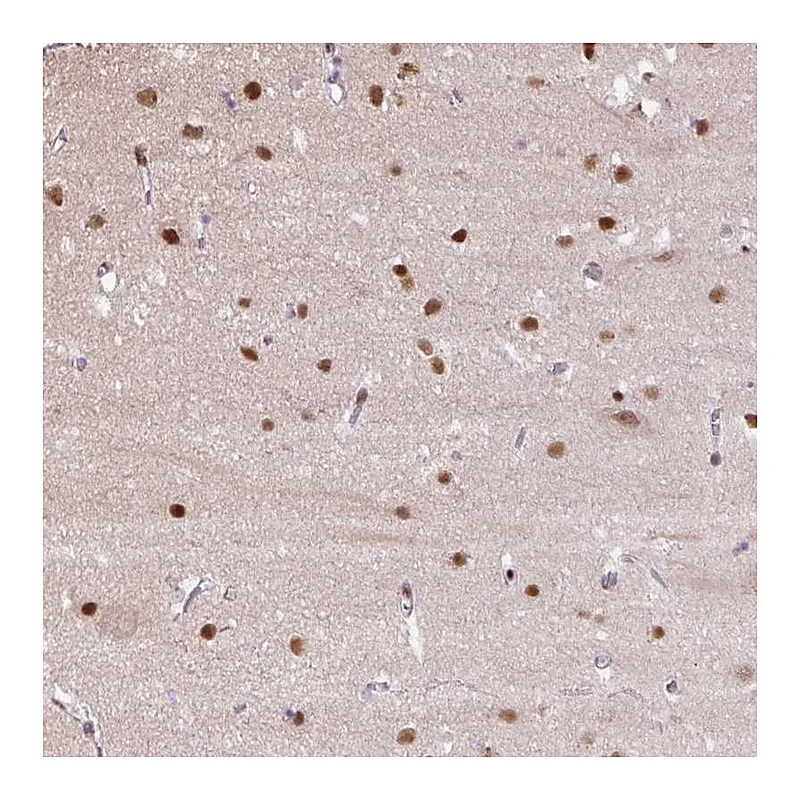 Atlas Antibodies Anti-TAF1A Antibody
