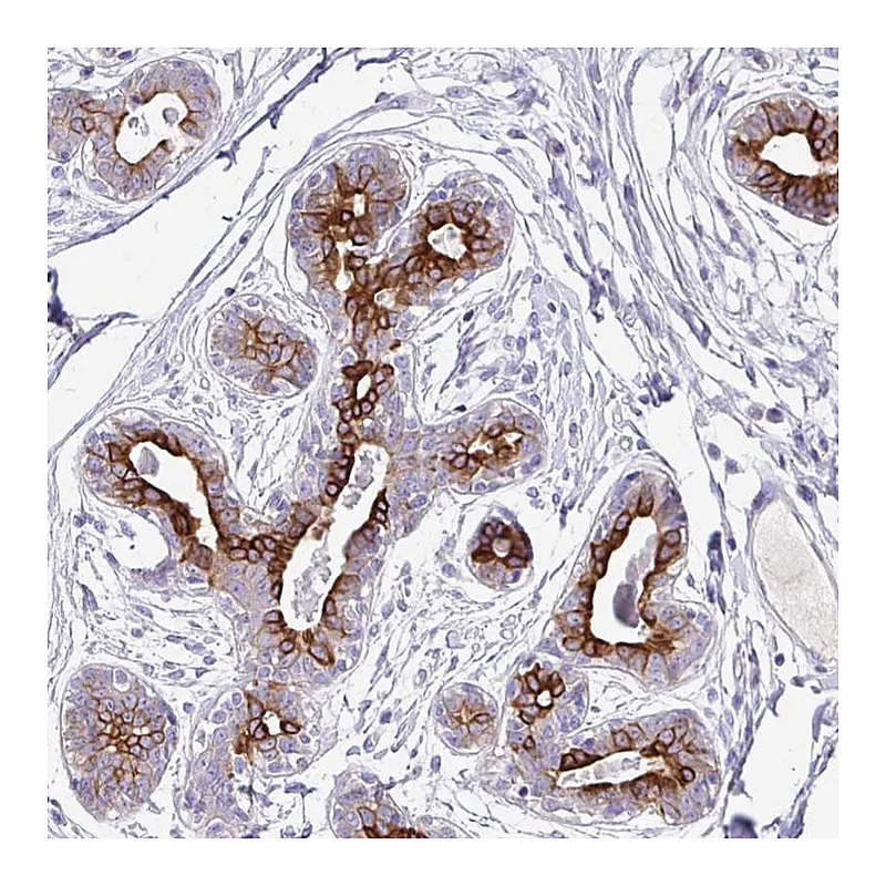 Atlas Antibodies Anti-TAF1D Antibody