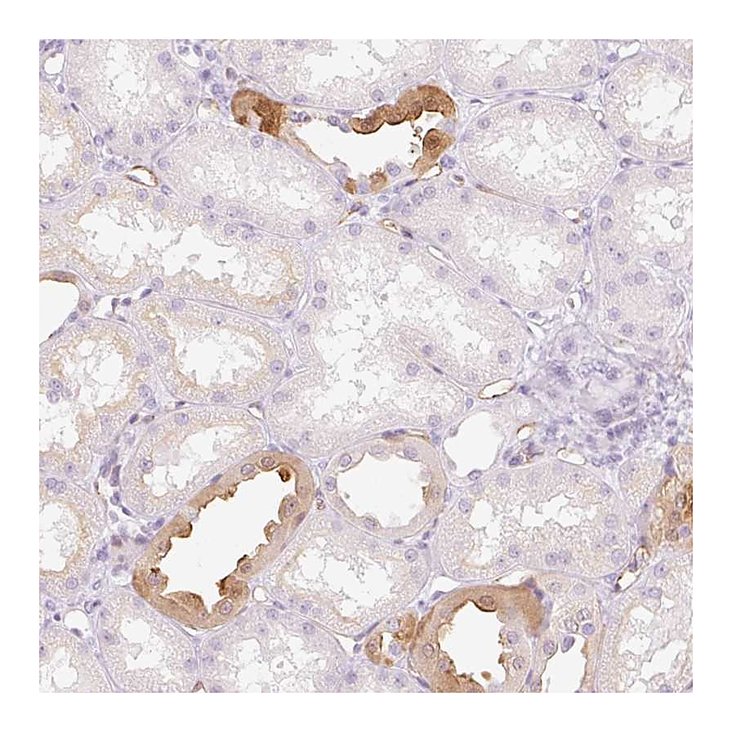 Atlas Antibodies Anti-TAF1L Antibody