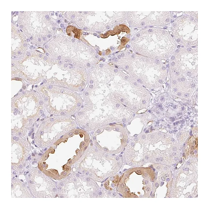 Atlas Antibodies Anti-TAF1L Antibody