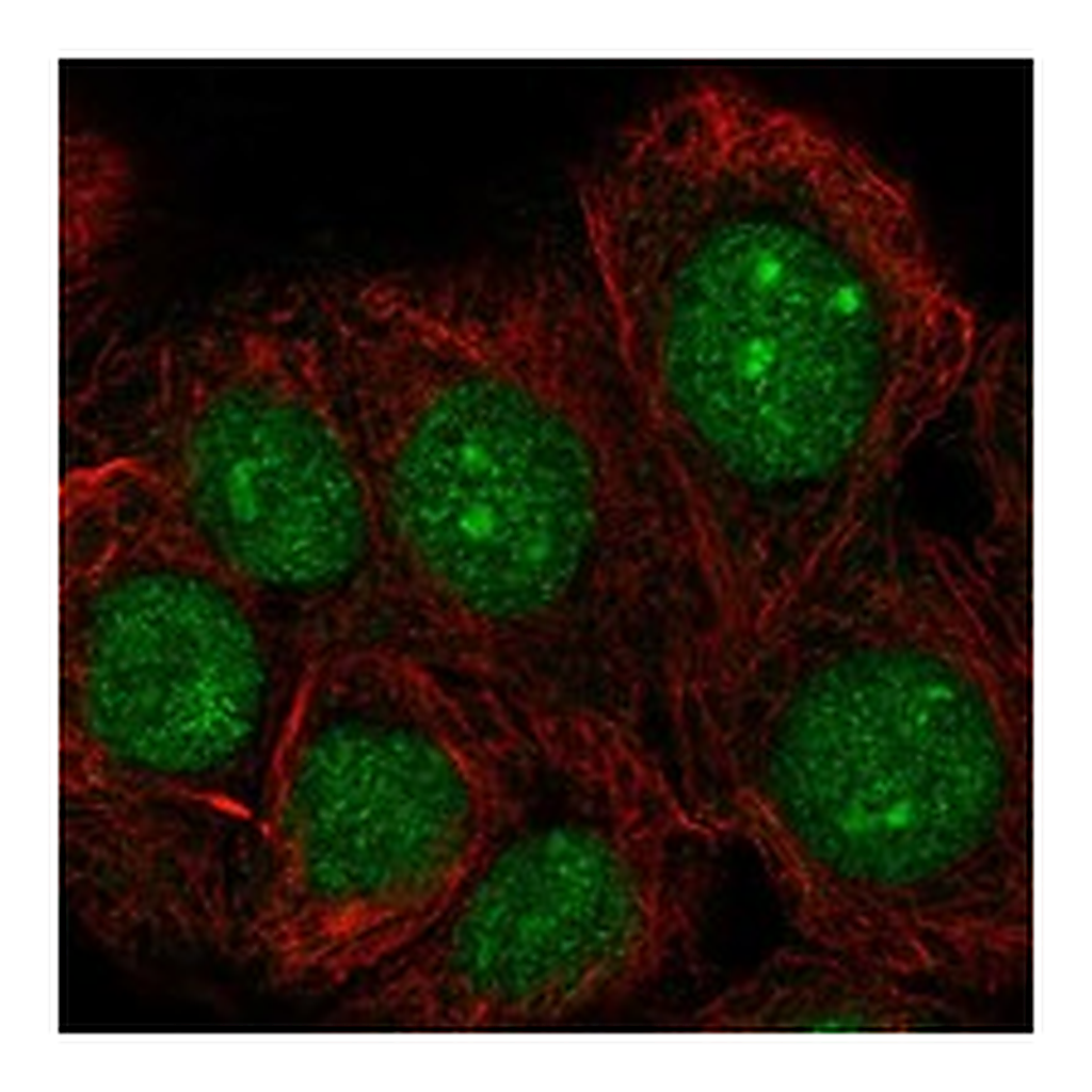 Atlas Antibodies Anti-TAF1D Antibody