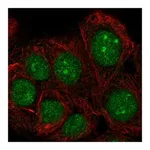 Atlas Antibodies Anti-TAF1D Antibody