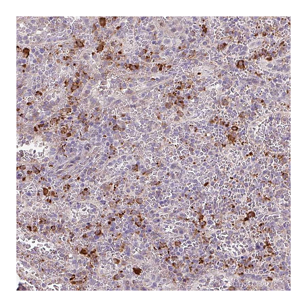 Atlas Antibodies Anti-TAF1D Antibody