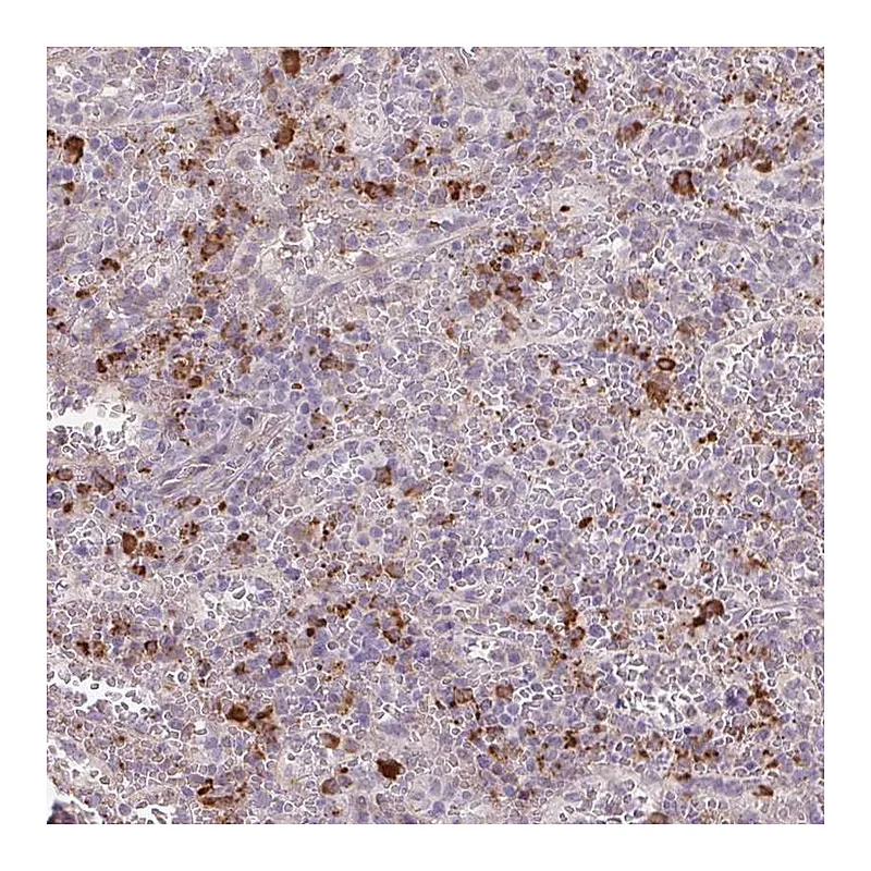Atlas Antibodies Anti-TAF1D Antibody