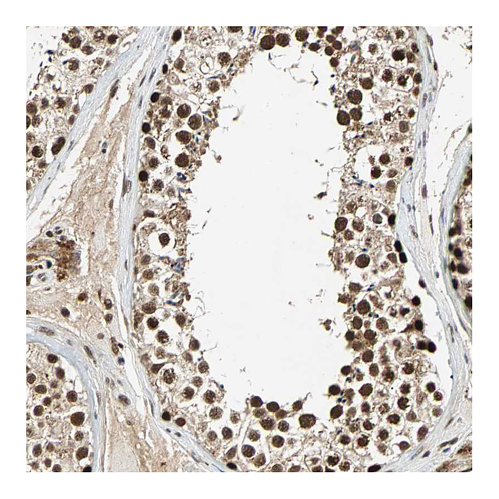 Atlas Antibodies Anti-TAF5 Antibody