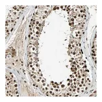 Atlas Antibodies Anti-TAF5 Antibody