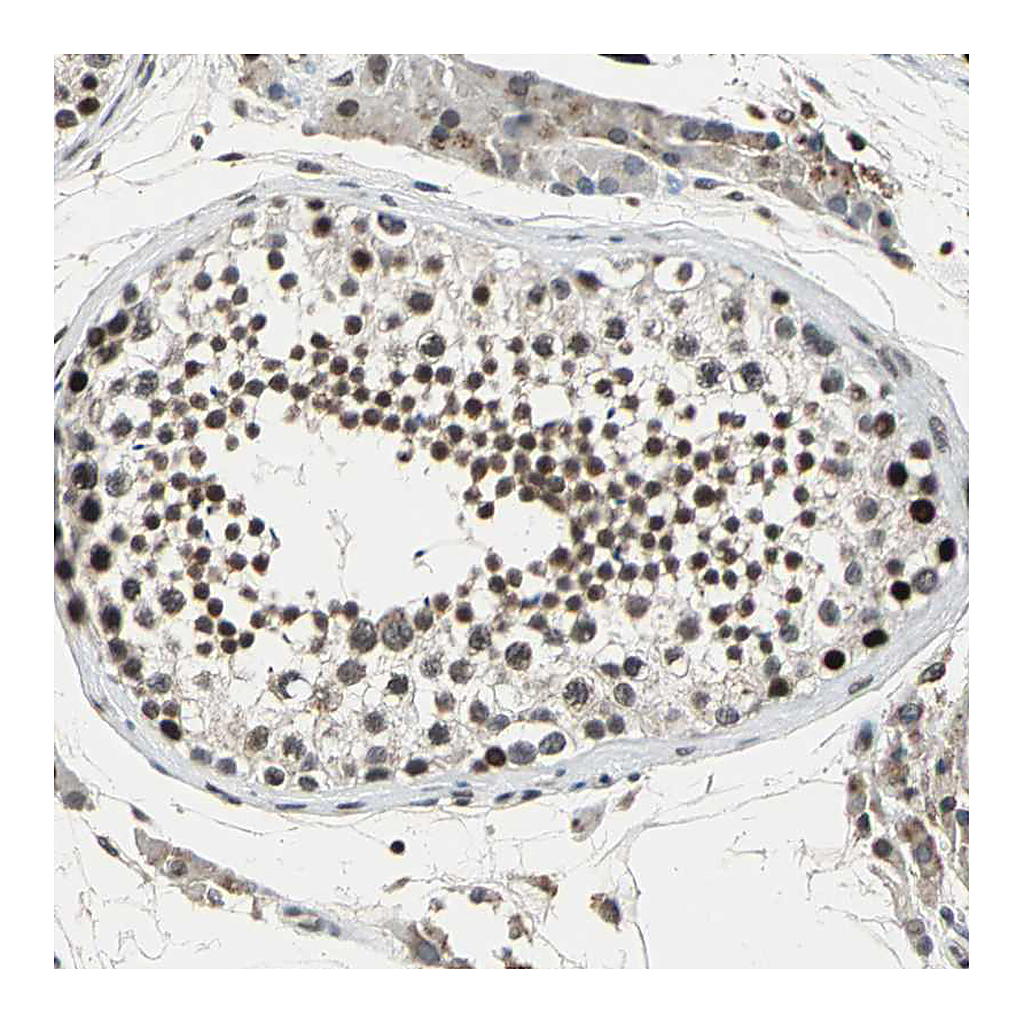 Atlas Antibodies Anti-TAF6 Antibody