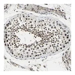 Atlas Antibodies Anti-TAF6 Antibody