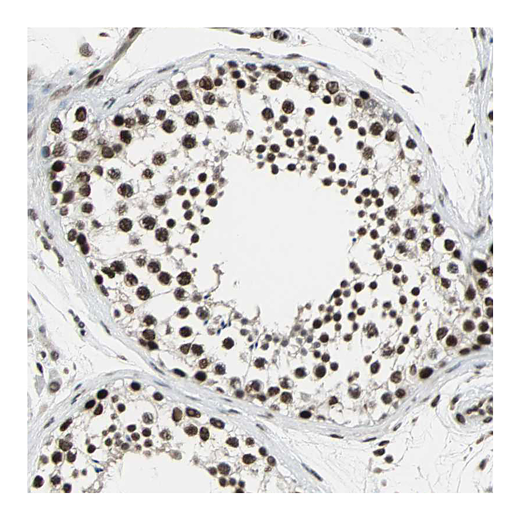 Atlas Antibodies Anti-TAF5 Antibody