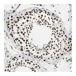 Atlas Antibodies Anti-TAF5 Antibody
