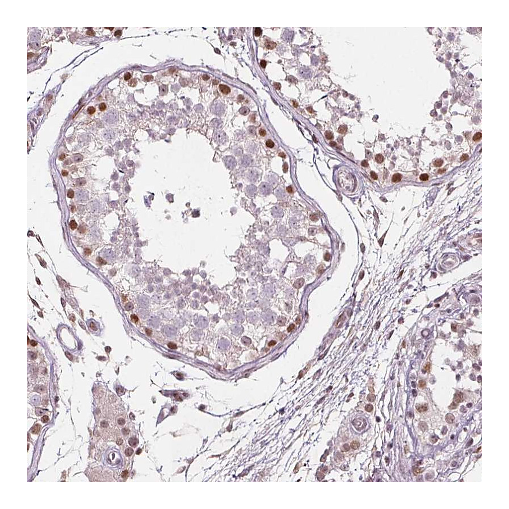 Atlas Antibodies Anti-TAF6L Antibody