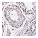 Atlas Antibodies Anti-TAF6L Antibody
