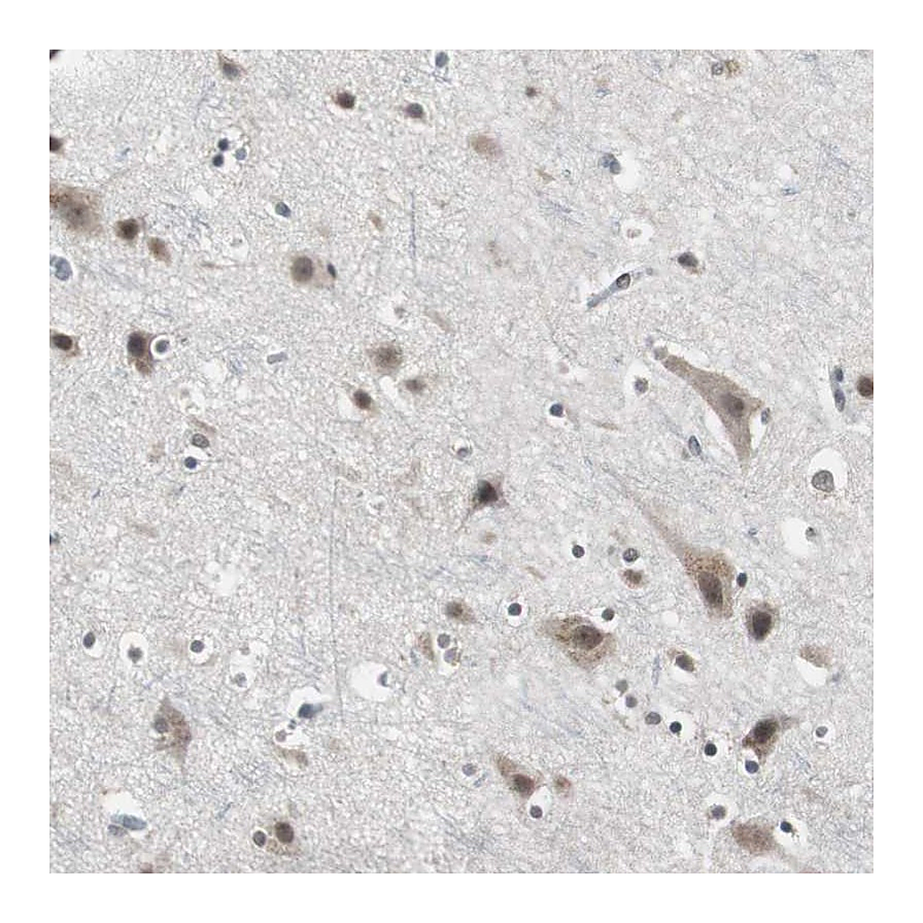 Atlas Antibodies Anti-TAF7 Antibody