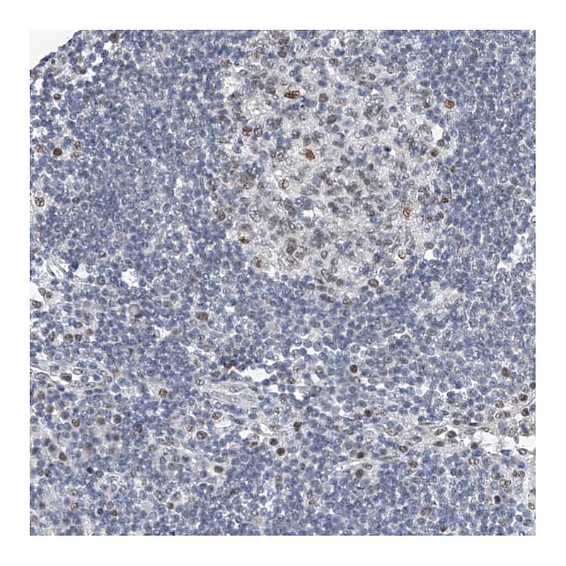 Atlas Antibodies Anti-TAF8 Antibody
