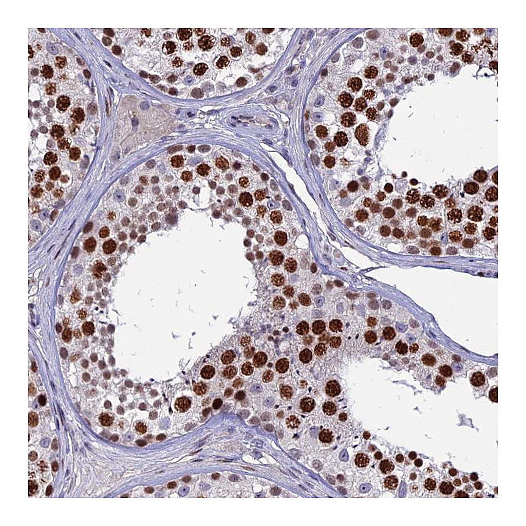Atlas Antibodies Anti-TAF9B Antibody