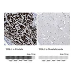 Atlas Antibodies Anti-TAGLN Antibody
