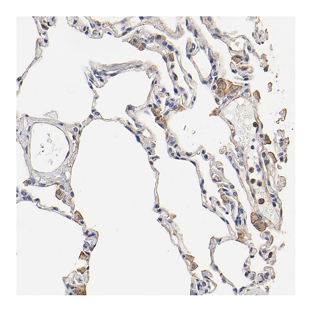 Atlas Antibodies Anti-TAGLN2 Antibody