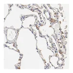 Atlas Antibodies Anti-TAGLN2 Antibody
