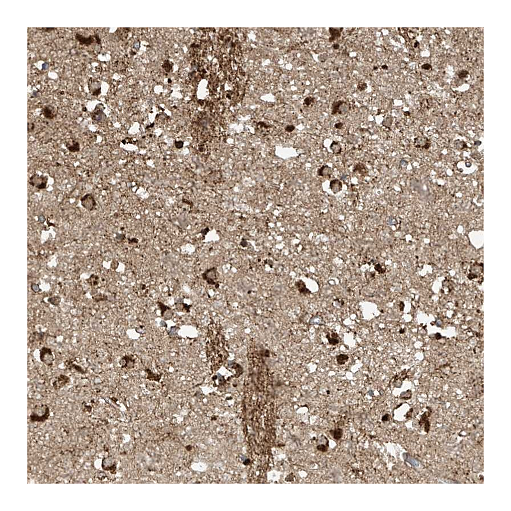 Atlas Antibodies Anti-TAGAP Antibody