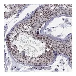 Atlas Antibodies Anti-TAF9 Antibody