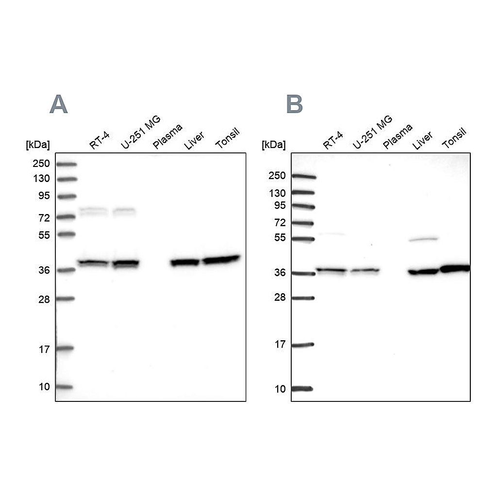 Atlas Antibodies Anti-TALDO1 Antibody