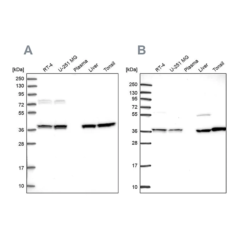 Atlas Antibodies Anti-TALDO1 Antibody