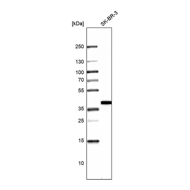 Atlas Antibodies Anti-TALDO1 Antibody