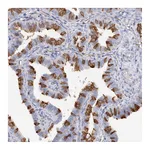 Atlas Antibodies Anti-TAMM41 Antibody