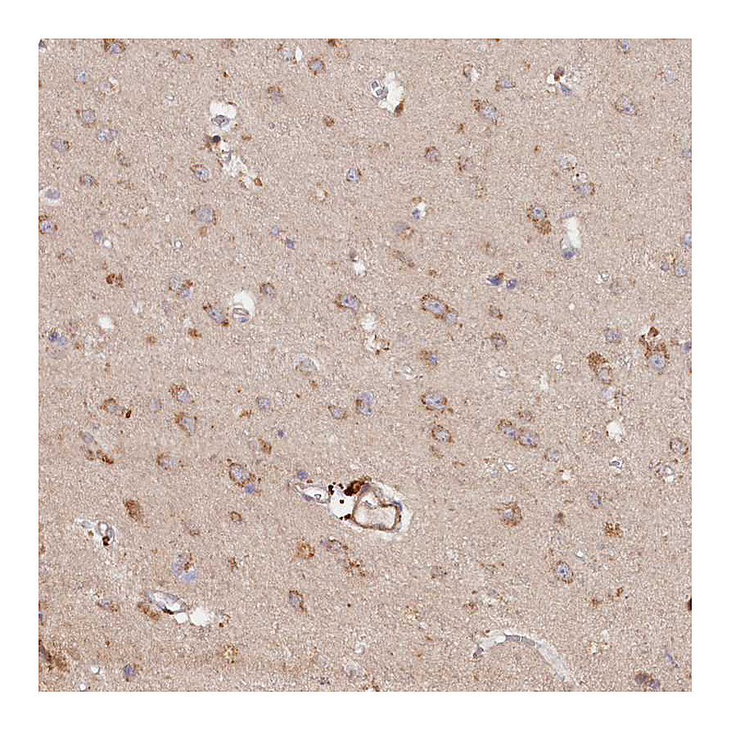 Atlas Antibodies Anti-TANGO6 Antibody