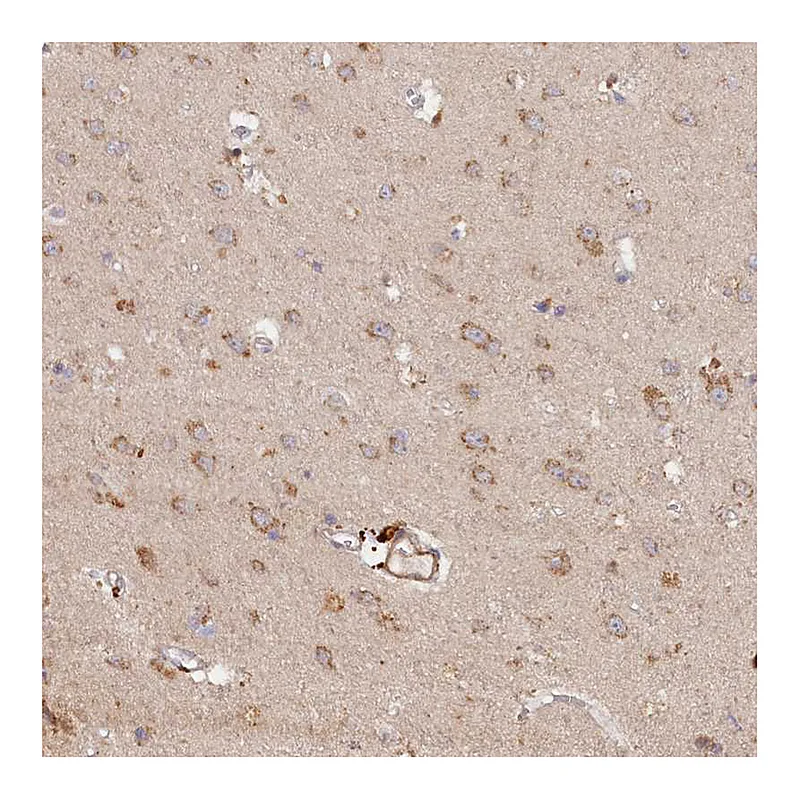 Atlas Antibodies Anti-TANGO6 Antibody
