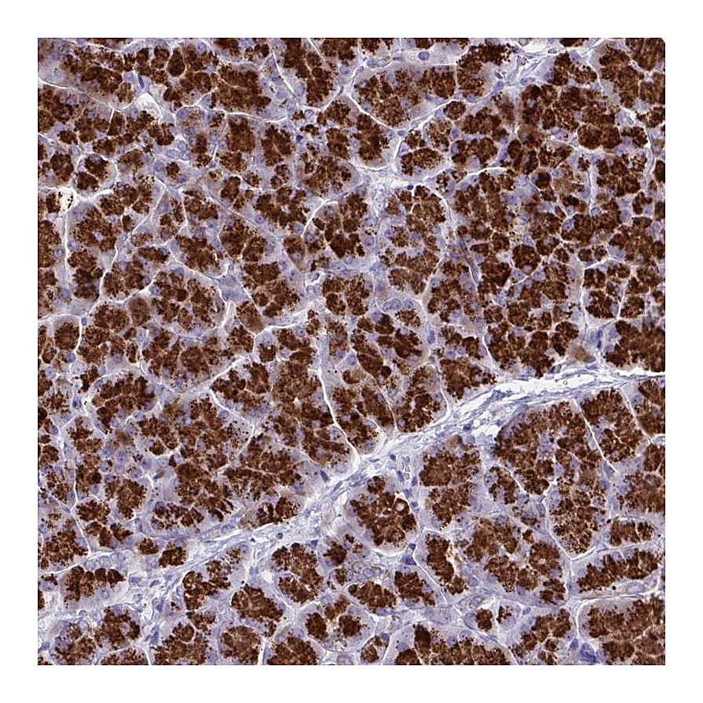 Atlas Antibodies Anti-TANK Antibody
