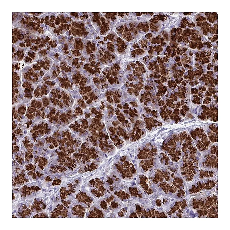 Atlas Antibodies Anti-TANK Antibody