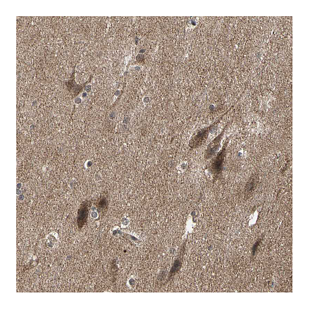 Atlas Antibodies Anti-TAOK1 Antibody