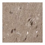 Atlas Antibodies Anti-TAOK1 Antibody