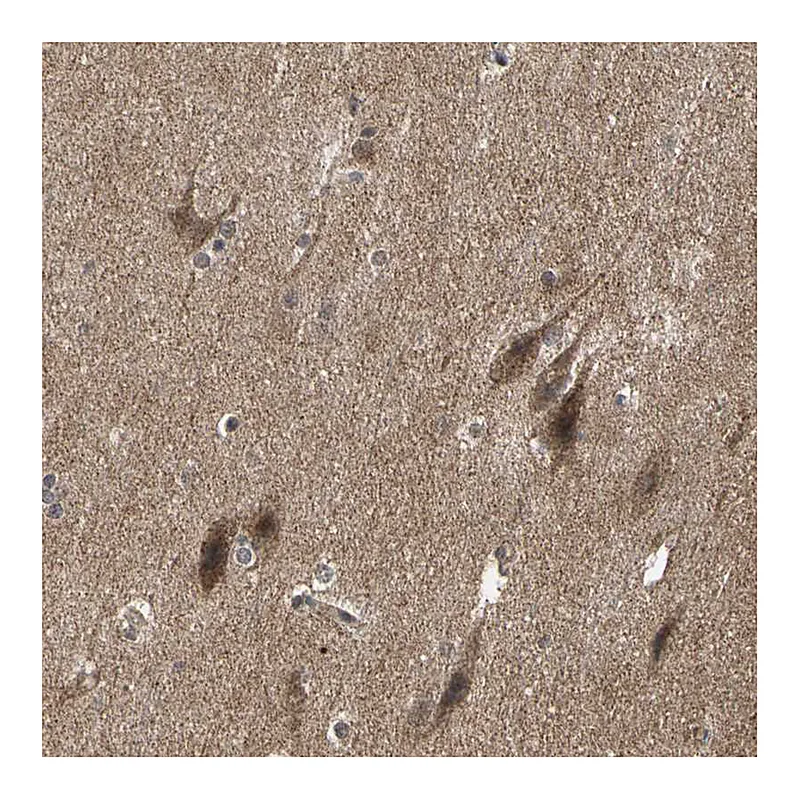 Atlas Antibodies Anti-TAOK1 Antibody