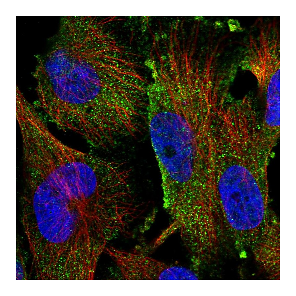 Atlas Antibodies Anti-TAMM41 Antibody