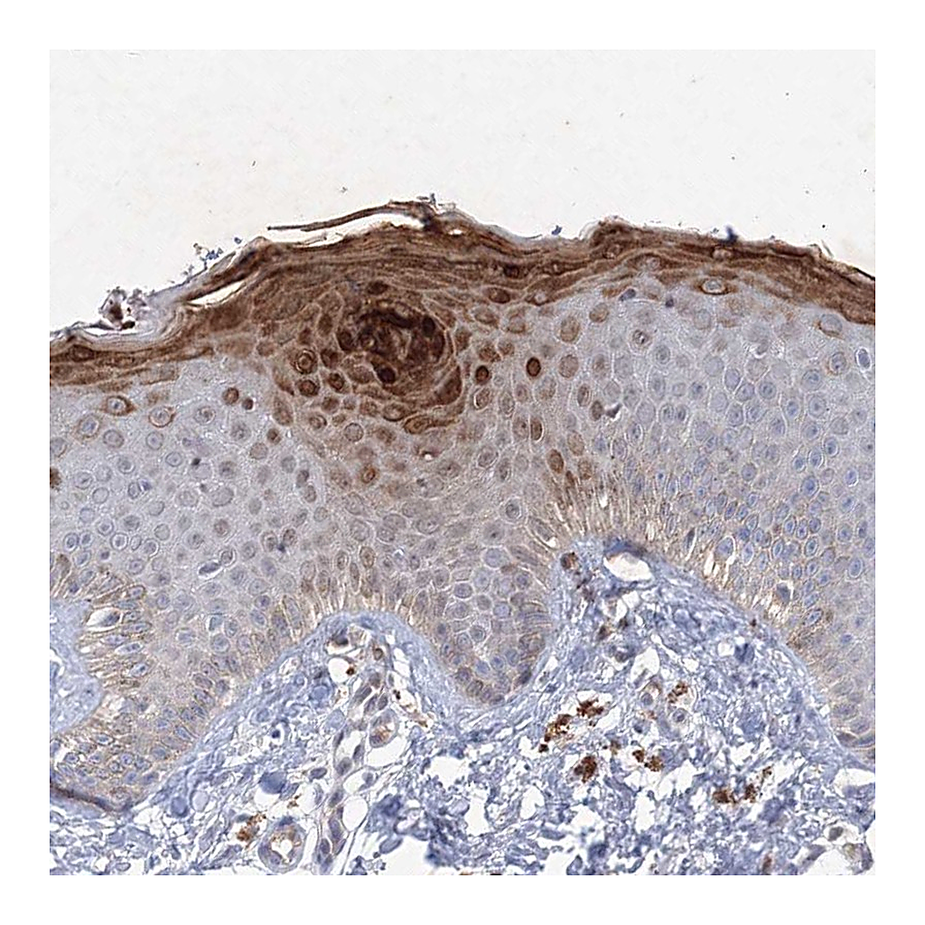 Atlas Antibodies Anti-TANC1 Antibody