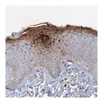 Atlas Antibodies Anti-TANC1 Antibody
