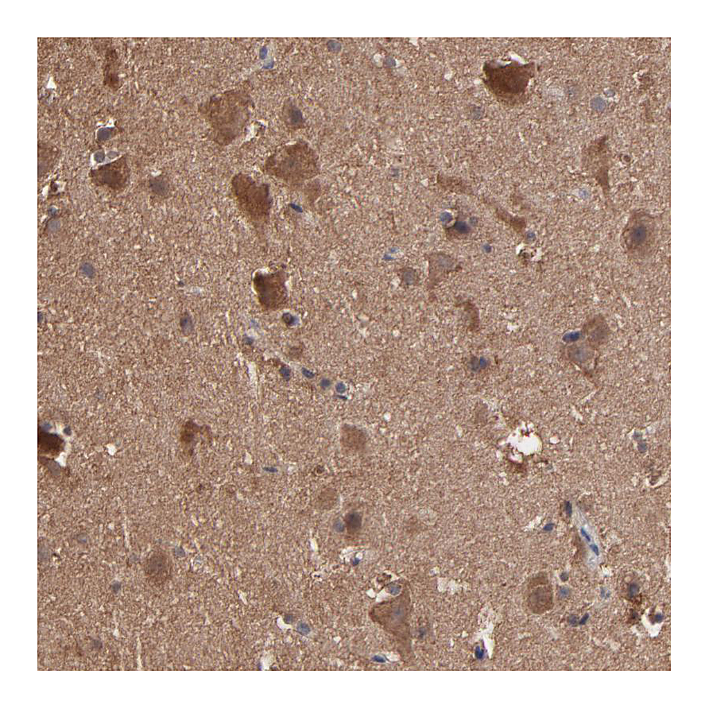 Atlas Antibodies Anti-TANGO2 Antibody