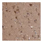 Atlas Antibodies Anti-TANGO2 Antibody