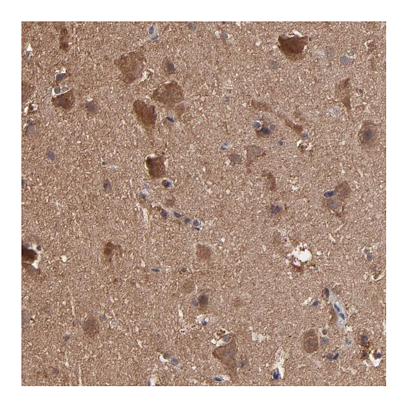 Atlas Antibodies Anti-TANGO2 Antibody