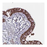 Atlas Antibodies Anti-TANK Antibody