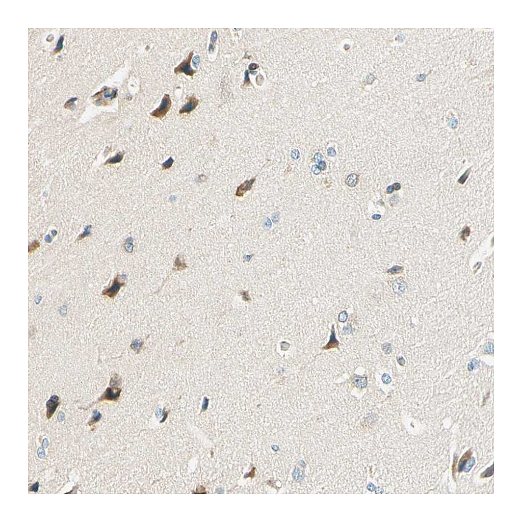 Atlas Antibodies Anti-TAOK2 Antibody