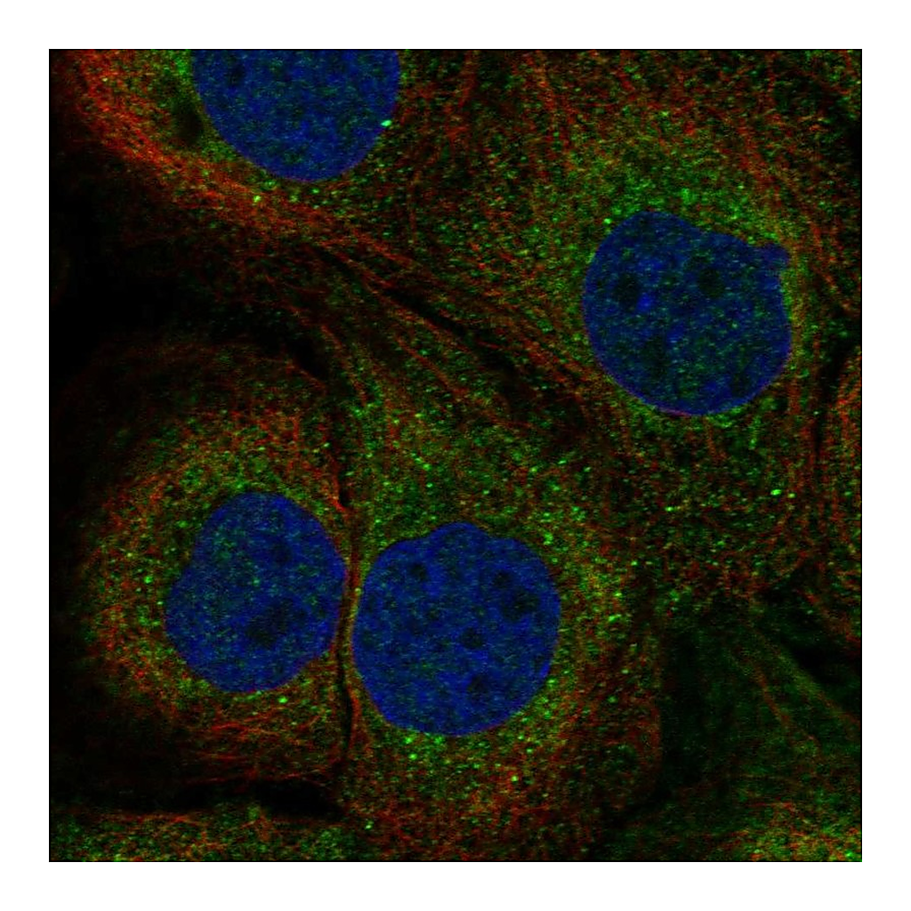 Atlas Antibodies Anti-TAP1 Antibody