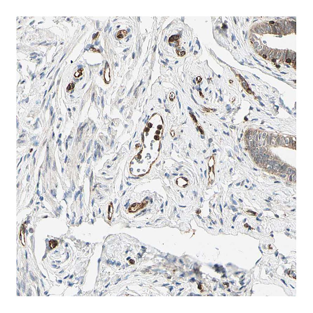 Atlas Antibodies Anti-TAPBP Antibody