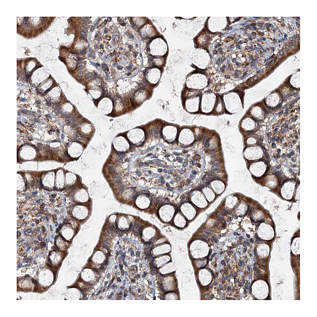 Atlas Antibodies Anti-TAPBPL Antibody