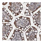 Atlas Antibodies Anti-TAPBPL Antibody